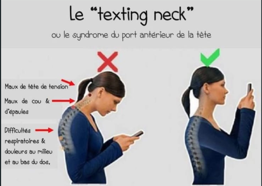 PatrickFavrel's tweet photo. #Numerique #smartphone & #TextingNeck : Le cou du texto...🤔 https://t.co/4JLgPrQU25