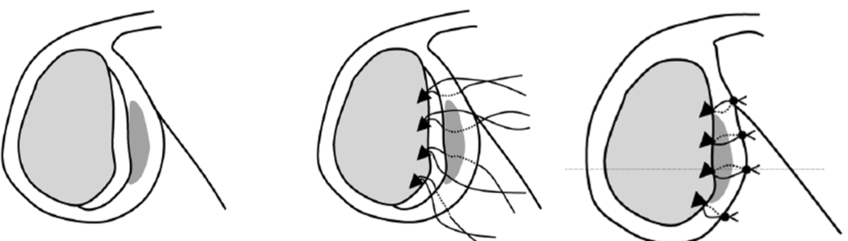 Peter Millett, MD tweet media