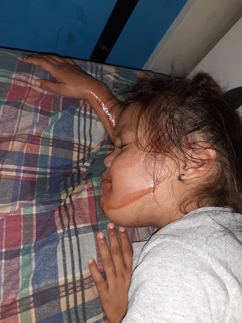 jose3045's tweet photo. Mi pequeña necesita ser operada por tercera vez para continuar con su recuperación les pido me ayuden por la salud de mi pequeña 04126971970 @NicolasMaduro @dcabellor @ConCiliaFlores @MSomosVen @irisvarela @jorgerpsuv @TareckPSUV @Adan_Coromoto https://t.co/pVpQU7K9p4