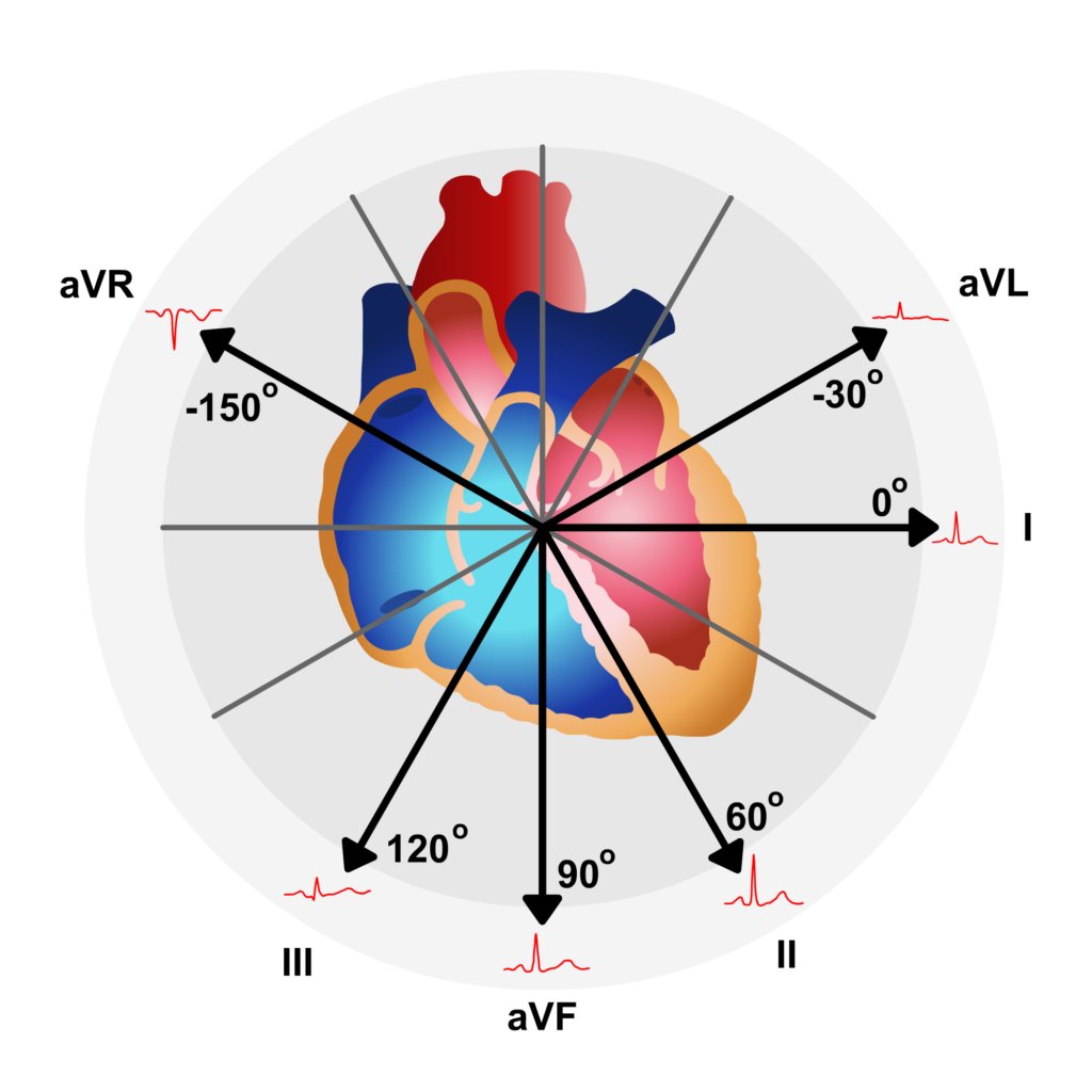 Heart Axis ECG