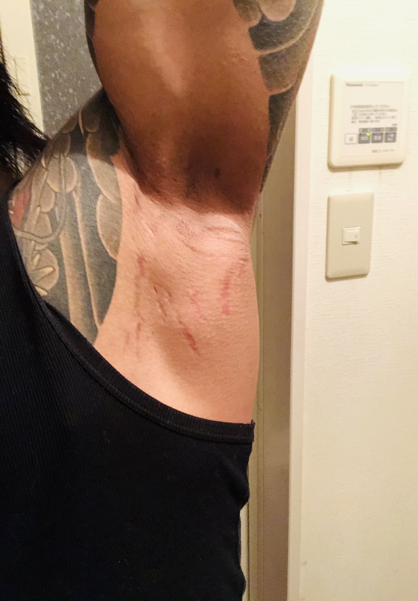 Yuichi 最近できたと思われる肉割れが出現してた トレーニーあるある