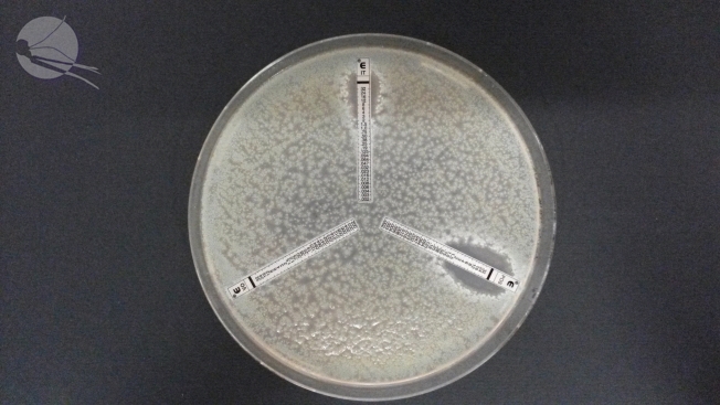 eANOFEL (@eanofel) on Twitter photo Azole resistance in Aspergillus is an increasing concern, at least in part due to the collateral damage of fungicides use in the environment. Here is a multi-azole resistant "TR46" strain (Etest method). 👉World Aspergillosis Day is tomorrow #worldaspergillosisday <a href="/aspertrust/">Aspergillosis Trust</a> Azole resistance in Aspergillus is an increasing concern, at least in part due to the collateral damage of fungicides use in the environment. Here is a multi-azole resistant "TR46" strain (Etest method). 👉World Aspergillosis Day is tomorrow #worldaspergillosisday <a href="/aspertrust/">Aspergillosis Trust</a>