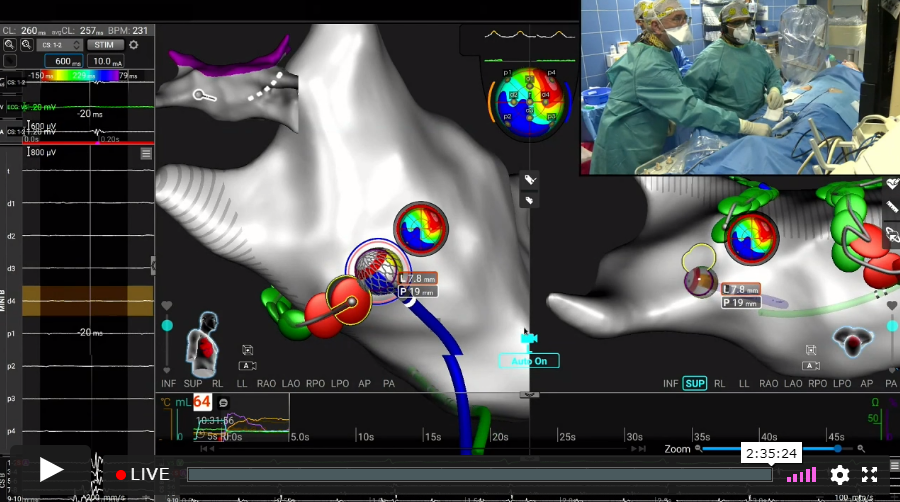 Real-time RF/PF case by Vivek Reddy at #AFSymposium2021
