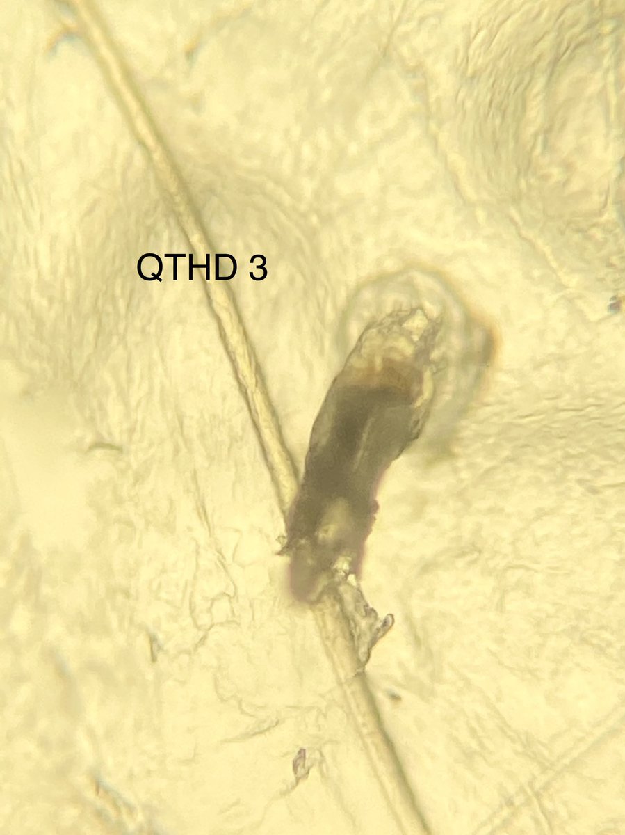 zoo2700's tweet photo. Yep- they live, eat and have sex on our faces and our #ZOO2700 students are eager to see THEIR face mites!  They have slept with their nasal strips and mailed us their mites. We have begun the search for their #Demodexmites #facemites #RemoteInverts https://t.co/W6JqxtP521