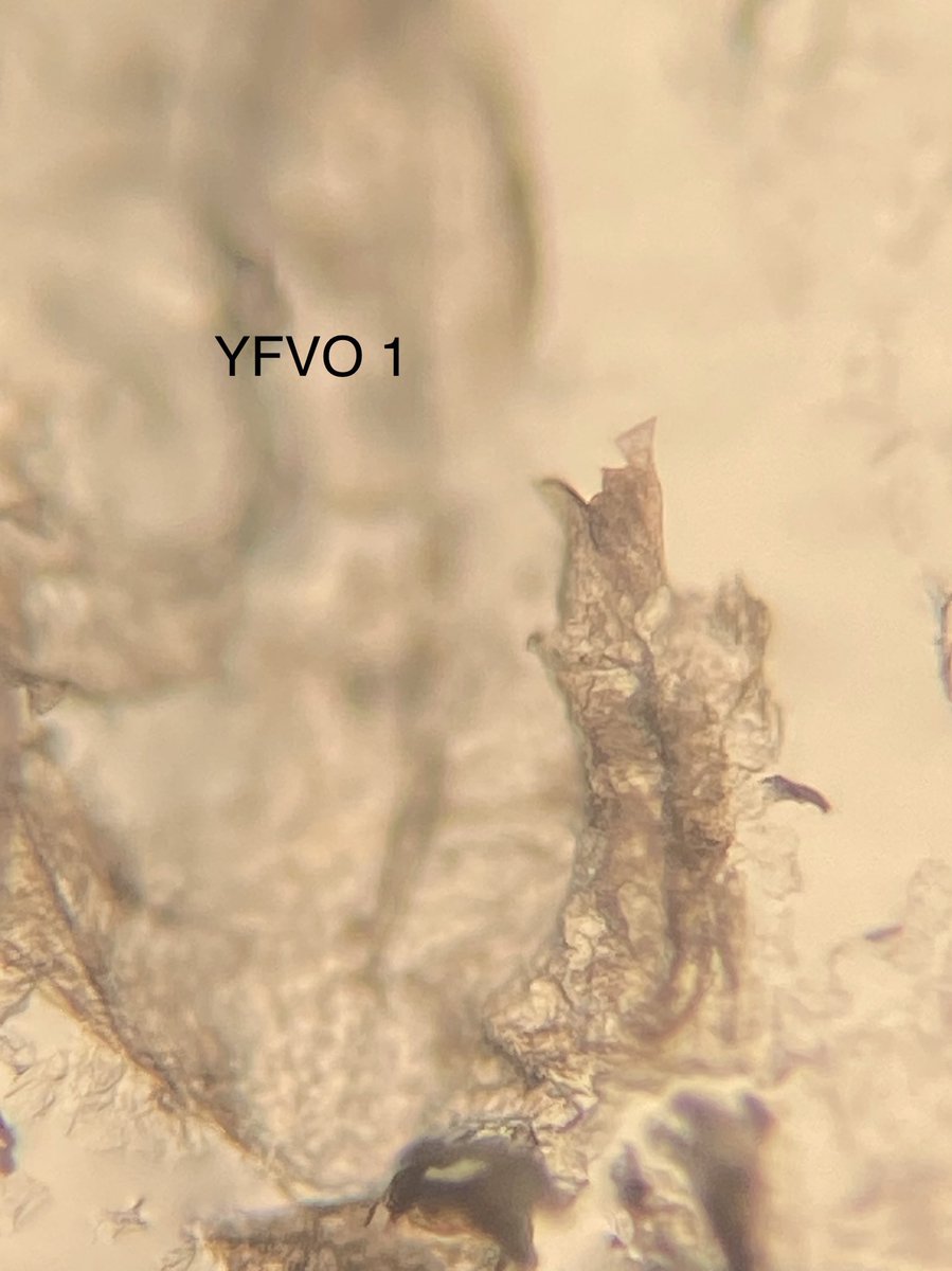 zoo2700's tweet photo. Yep- they live, eat and have sex on our faces and our #ZOO2700 students are eager to see THEIR face mites!  They have slept with their nasal strips and mailed us their mites. We have begun the search for their #Demodexmites #facemites #RemoteInverts https://t.co/W6JqxtP521