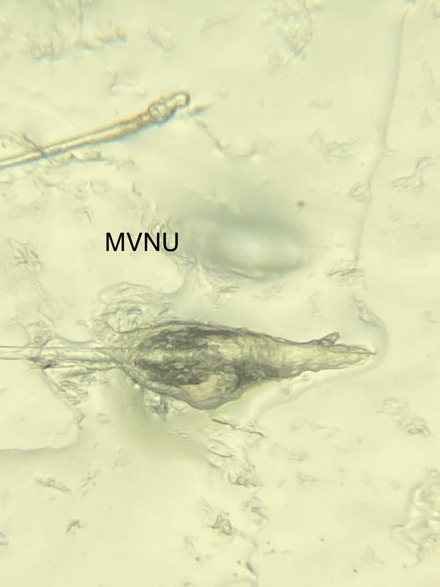 zoo2700's tweet photo. Yep- they live, eat and have sex on our faces and our #ZOO2700 students are eager to see THEIR face mites!  They have slept with their nasal strips and mailed us their mites. We have begun the search for their #Demodexmites #facemites #RemoteInverts https://t.co/W6JqxtP521