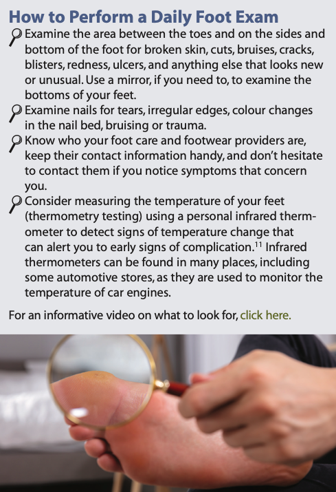 DiabeticFootCa's tweet photo. How to perform a daily foot exam? #Savethe4 #EndAmputation #FootHealth
https://t.co/JKwUxJHo5D https://t.co/KPpcoyQ4dM