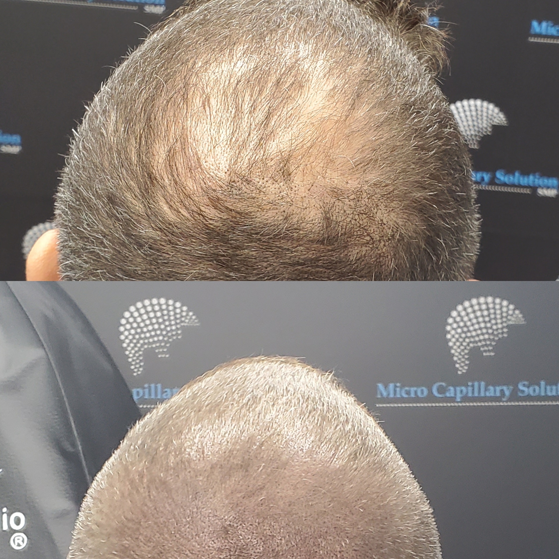 Micro Capillary Solution (microcapillary) / Twitter