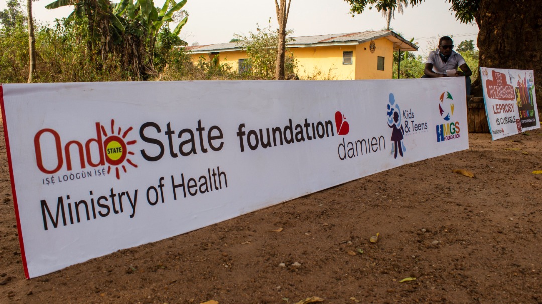 How it went down #WLD World Leprosy Day GAMES DAY Celebration 31st January 2021 @ Ago Ireti Leprosarium, Akure. #beatLeprosy #endstigma <a href="/dfb_nigeria/">DfbNigeria</a> <a href="/dahw_germany/">DAHW</a> <a href="/ntblcp/">NTBLCP</a>