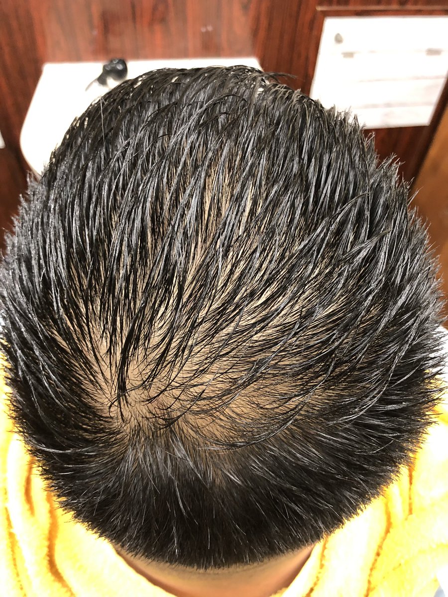 頭皮が見える人と繋がりたい 頭皮が見える人と繋がりたい