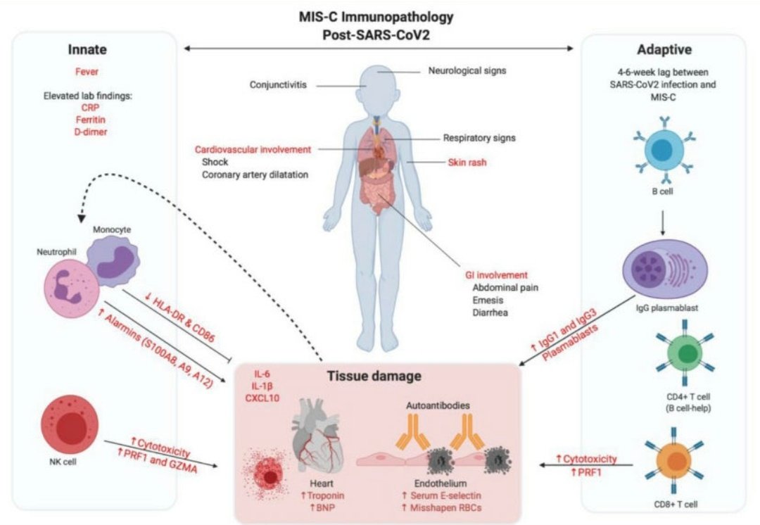 Post-infectious inflammatory disease in #MIS_C features elevated cytotoxicity signatures and autoreactivity that correlates with severity.

#SARSCoV2 #COVID19 #PedsICU #PIMSTS

@OpenPicu @paccman_asia @WFPICCS @ESPNIC_Society @PICJournalWatch
 medrxiv.org/content/10.110…