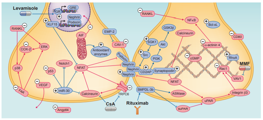 NDTsocial's tweet photo. 🆕Review:
The podocyte as a direct target of glucocorticoids in nephrotic syndrome
📸Schematic overview of proposed molecules affected by glucocorticoid treatment
📖https://t.co/jTm2UyINM8👈
@Nierstichting https://t.co/GPytcjHWFz