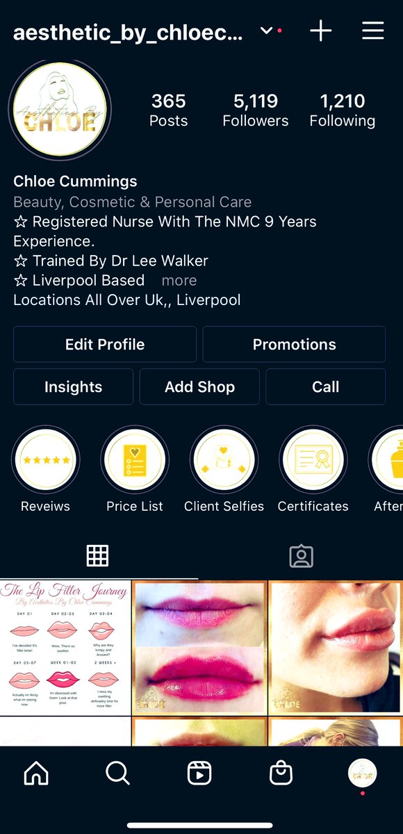Dm me for all aesthetic enquires and follow my instagram page aesthetic_by_chloecummings 💋💯