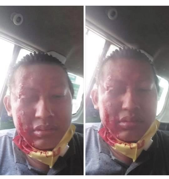 soezeya's tweet photo. A journalist got attacked by military supporters in Yangon #myanmarmilitarycoup  #SaveMyanmar https://t.co/LHcaNc15fE