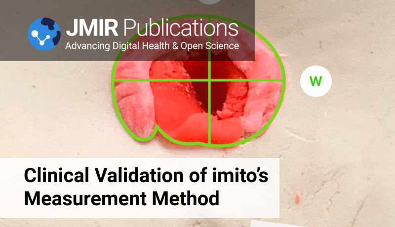 imito_ag's tweet photo. 🥳 Excellent news:
Based on 61 investigated pressure ulcers, our measurement method demonstrated an excellent validity as well as an ICCs>0.90 #sizematters #measurement #clinicalstudies #wounds #objectivity #digitalhealth #healthcare #imitorocks
https://t.co/SmLb7VY7S5 https://t.co/GuZK1zn1NM