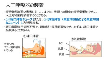 神谷浩史のバイク事故その後 喉の傷は手術跡 いつ退院 中村悠一も事故 代役まとめ アスネタ 芸能ニュースメディア