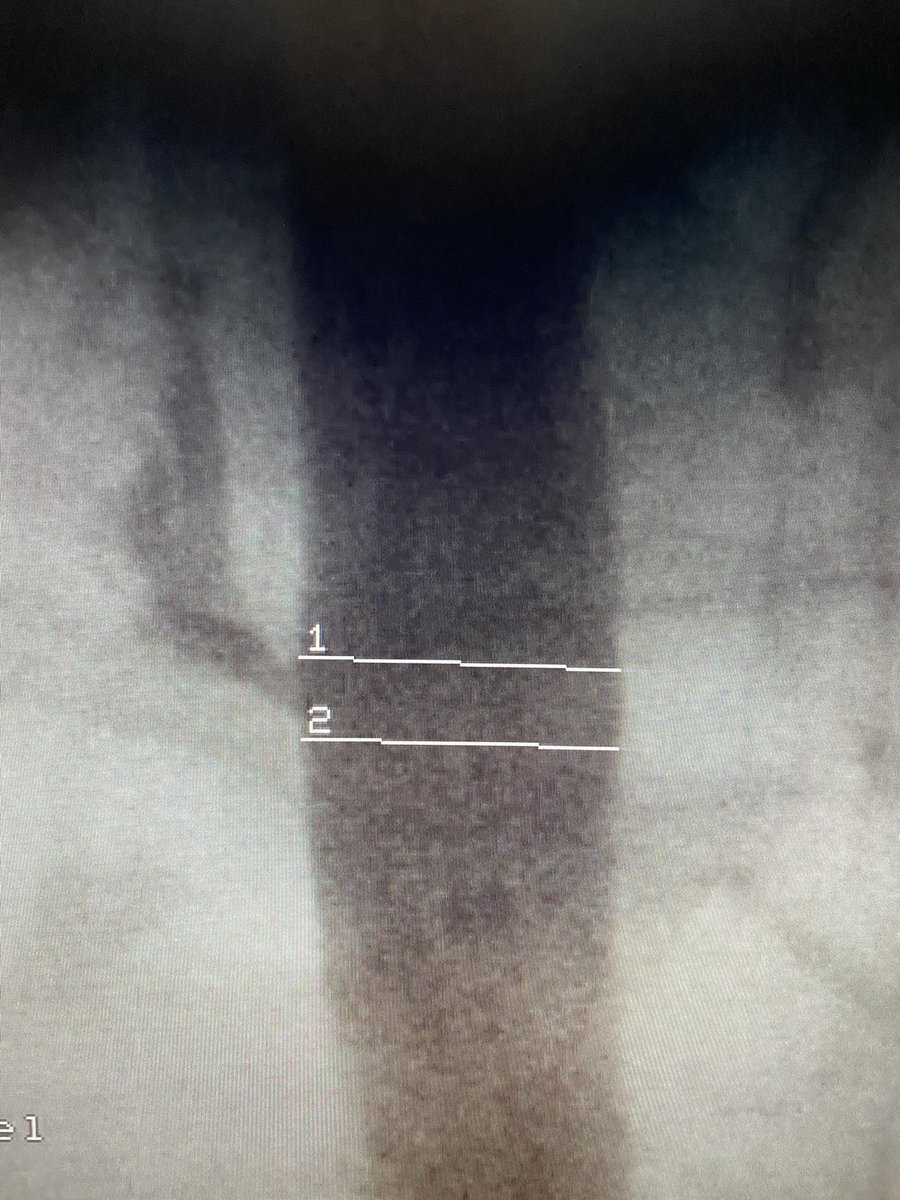 Fabricio Vassallo, MD, PhD tweet media