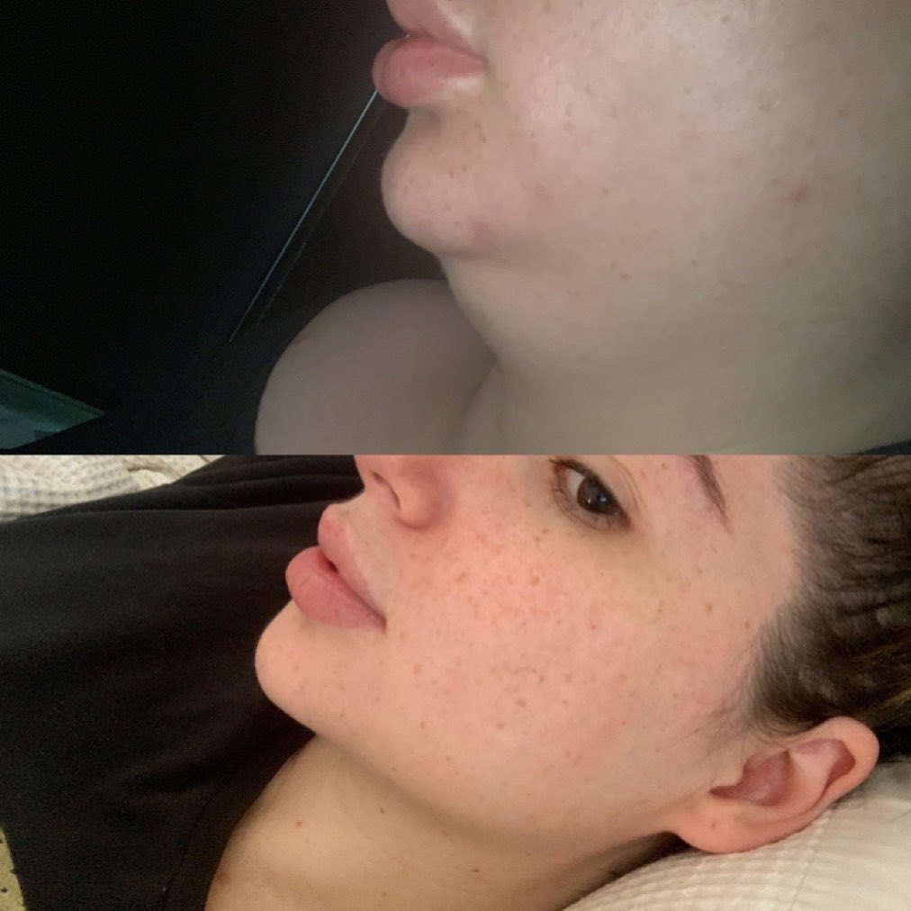 CHUBSPO THREAD !! ♡︎