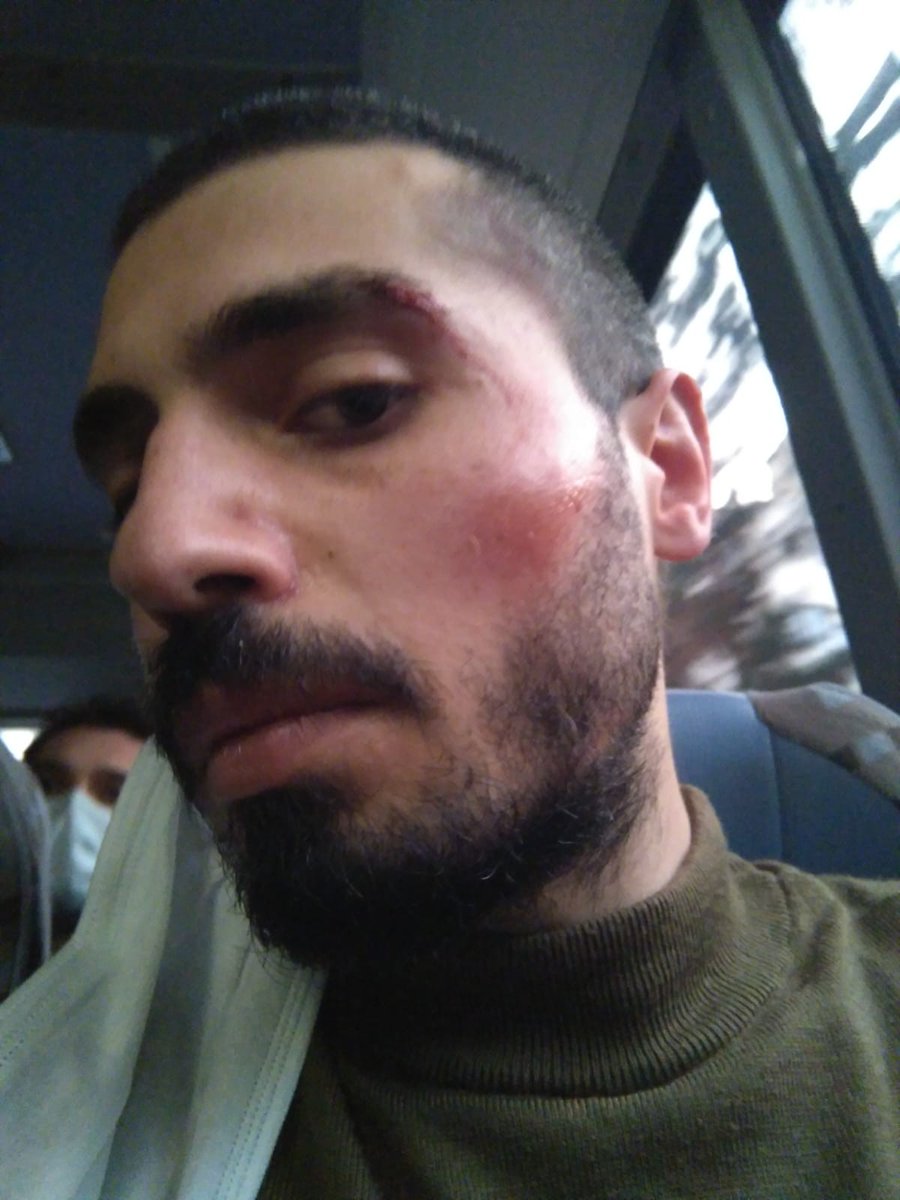 𝗦𝗬𝗞𝗣 on Twitter: "İstanbul ve İzmir'de düzenlenen Boğaziçi eylemlerinde polis çok sayıda öğrenciyi darp ederek gözaltına aldı. #BogaziciDireniyor… https://t.co/nH6HxZYDAk"