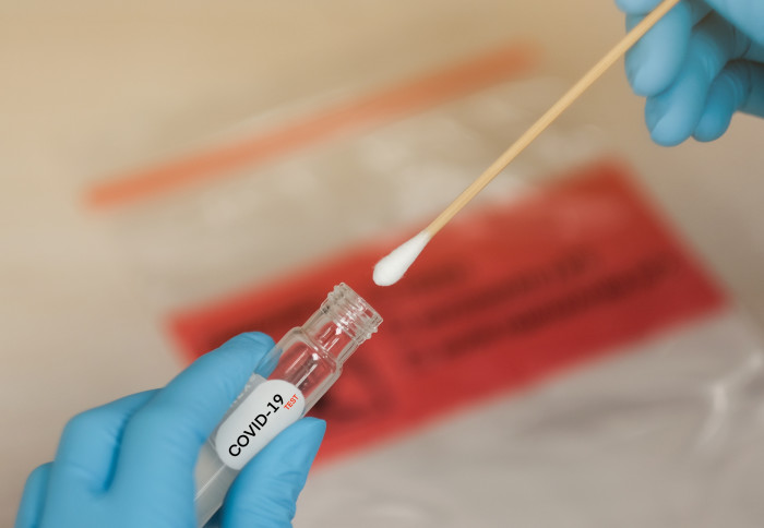 CllrGaryMalcolm's tweet image. I STRONGLY urge residents to comply with this. It is important we all do our part in stopping the spread of this #COVID variant in our communities.

For more information and to check whether your postcode is part of the testing scheme, visit: ealing.gov.uk/info/201262/co…