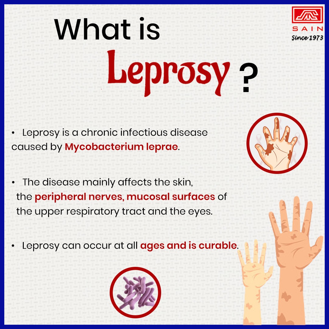 Today, almost 208,000 people worldwide are infected with leprosy, according to the World Health Organization, most of them in Africa and Asia. 
#worldleprosyday #leprosy #healthcare #healthcareindia #prejudice #sain #sainmedicaments #awareness #leprosydiseasecontrol #leprosyfacts