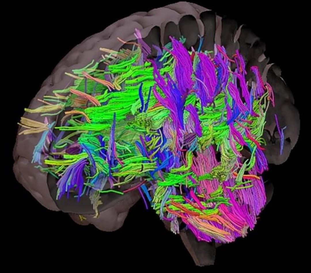 Brain 47. Нейровизуализация головного мозга. Нейровизуализация фото. Альцгеймер снимки мозга.