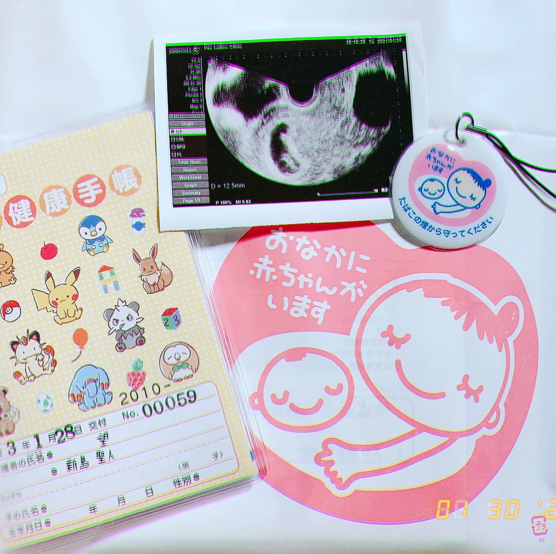 mn080914's tweet photo. 報告。
妊娠3ヶ月目に入りました。
第二の人生としてこれから歩んで行くって事で色々と頑張らないといけないですね。頑張りましょ。
きっとバカ親一直線です。笑 https://t.co/keqEvjtnkC