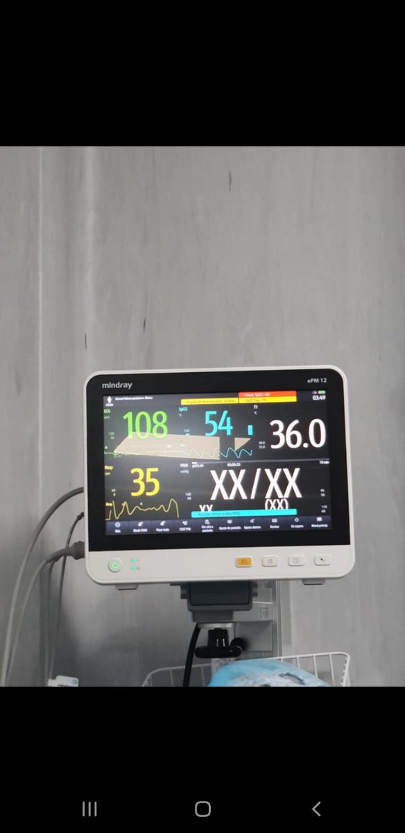 jfowks's tweet photo. La saturación de algunos pacientes UCI en Hosp Negreiros es muy baja. Ante la insuficiente presión de oxígeno por falta d mantenimiento, médicos 'bolsean' para salvar vidas: llenan una bolsa con oxígeno, la ponen en la boca del paciente y presionan con las manos https://t.co/FvKQZbKvHT