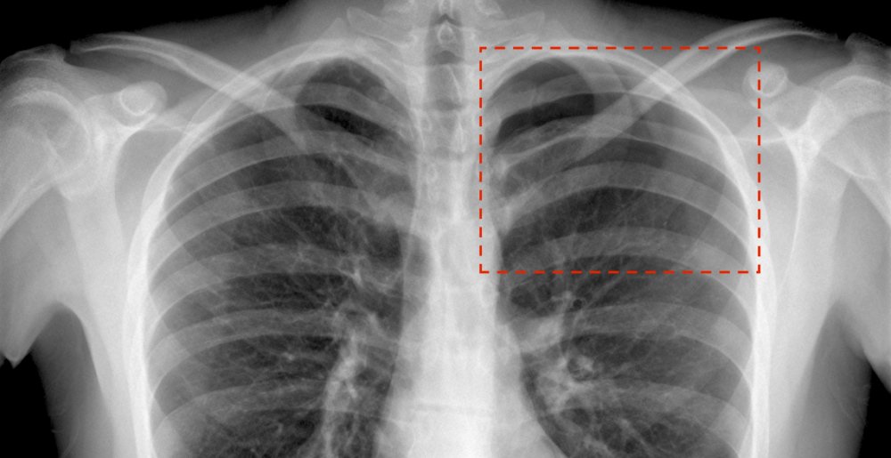 L’IA Milvue endosse la blouse des radiologues aux urgences, et cela ne fait que commencer...
 maddyness.com/2021/01/28/ia-…