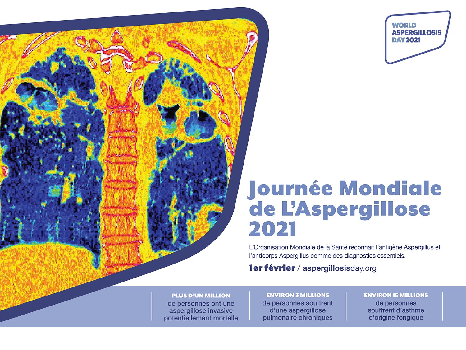Latest News Blog World Aspergillosis Day