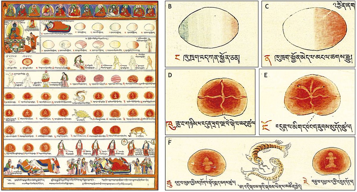 Rashmi Priya (@_priya_r) on Twitter photo What a fascinating article by <a href="/jbwallingford/">John Wallingford</a> <a href="/Dev_journal/">Development</a> 😮highlighting the rich history of developmental embryology in Asia and Latin America.
“if we mention Aristotle in developmental biology textbooks…we should also mention the Garbhāvakrāntisūtra”
dev.biologists.org/content/148/3/… What a fascinating article by <a href="/jbwallingford/">John Wallingford</a> <a href="/Dev_journal/">Development</a> 😮highlighting the rich history of developmental embryology in Asia and Latin America.
“if we mention Aristotle in developmental biology textbooks…we should also mention the Garbhāvakrāntisūtra”
dev.biologists.org/content/148/3/…