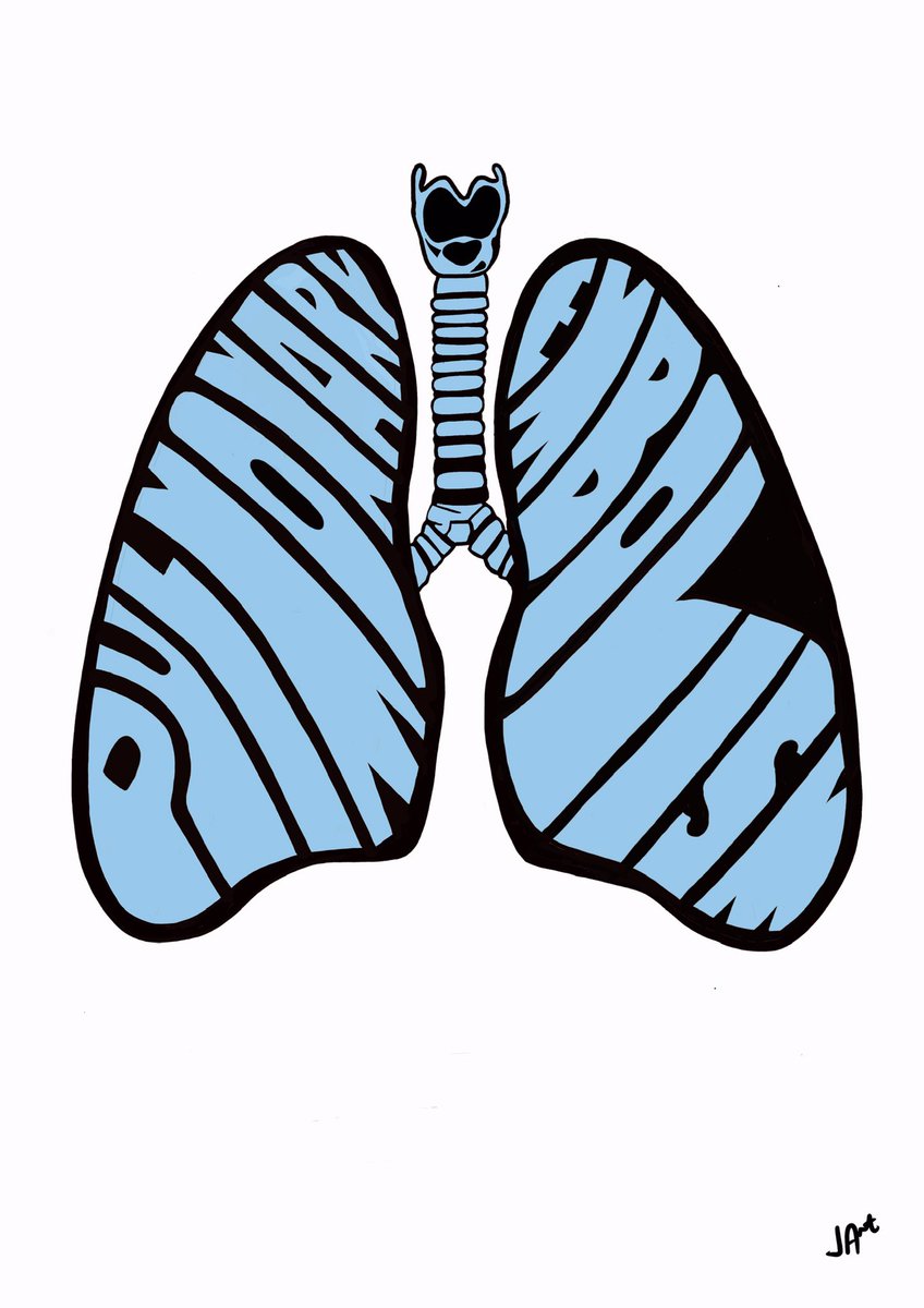 jonny_acheson's tweet photo. Really enjoying the #lungart.
The sketch on the left is a left sided #tensionpneumothorax which is squeezing the #lung on the right.
The sketch on the right is a #pulmonaryembolism which has caused #infarction #FOAMed #MedTwitter #lungs #respiratory #breath #NHS #healthcare #art https://t.co/4SIGfcyc19