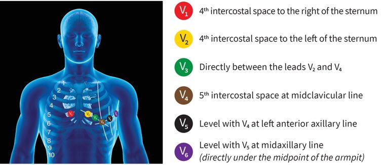 12 lead ecg placement mnemonic