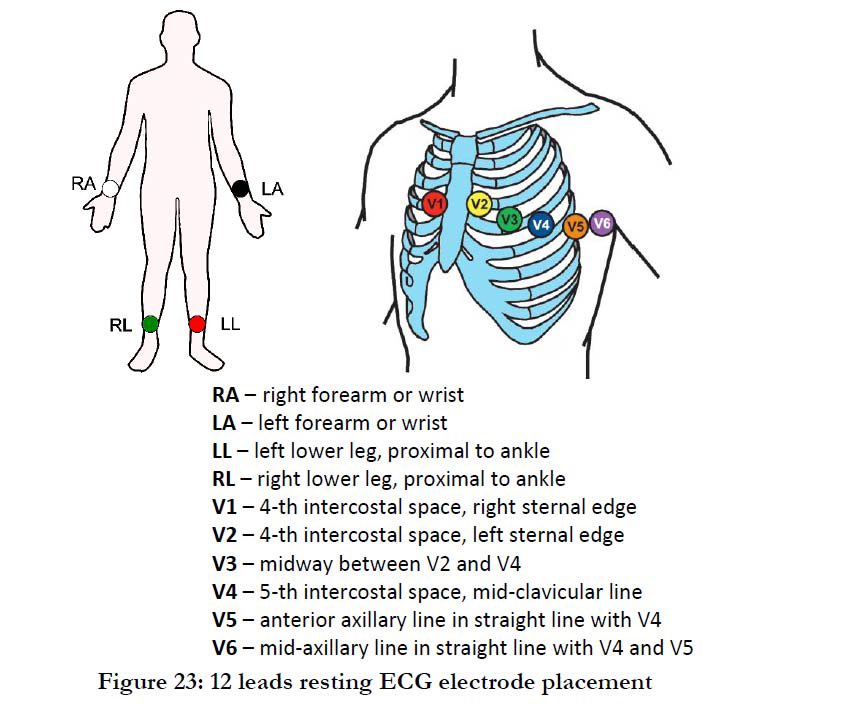 12 lead ecg placement mnemonic