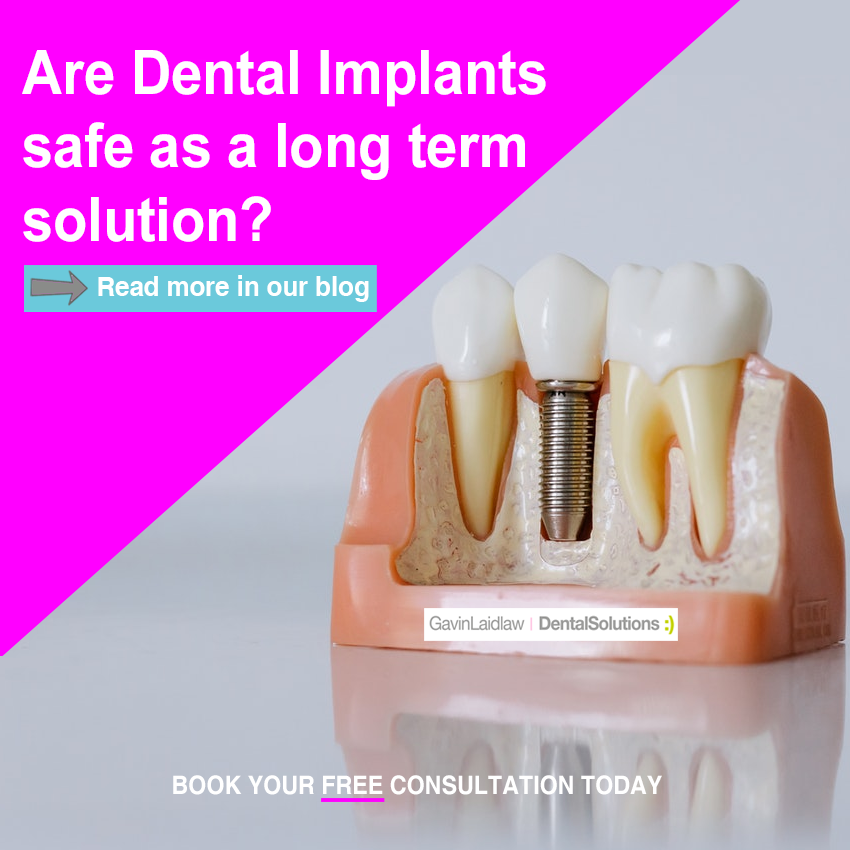 DentaISolutions's tweet photo. Our latest blog explores the longevity of #DentalImplants.
Among many other benefits, implants are considered a secure, fixed and long-term solution for your missing teeth problems. 
---> https://t.co/W8ocSuL9RV to find out more. https://t.co/DMlnxvFimY