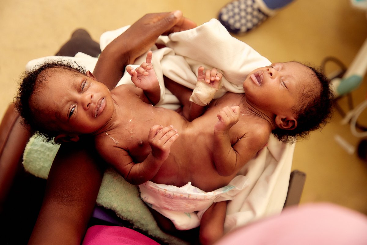 DMazingi's tweet photo. Please support this effort to raise money for Separation of a set of Conjoined Twins at Sally Mugabe Hospital in Zimbabwe. 

Click to Donate:  https://t.co/5BoU4I1oSC via @gofundme https://t.co/P1mUWhjQwk