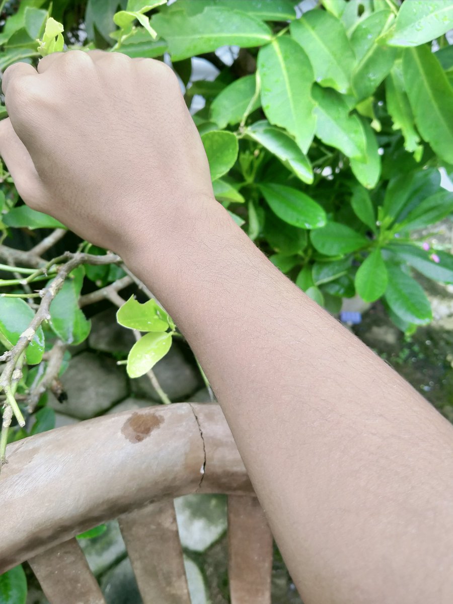 Ini before dan after aku pakai bodycare Scarlett whitening selama 2 mingguan #scarlettwhitening  #scarlett  #whitening  #bodycareroutine  #bodyscrub  #bodylotion  #showerscrubBefore             After