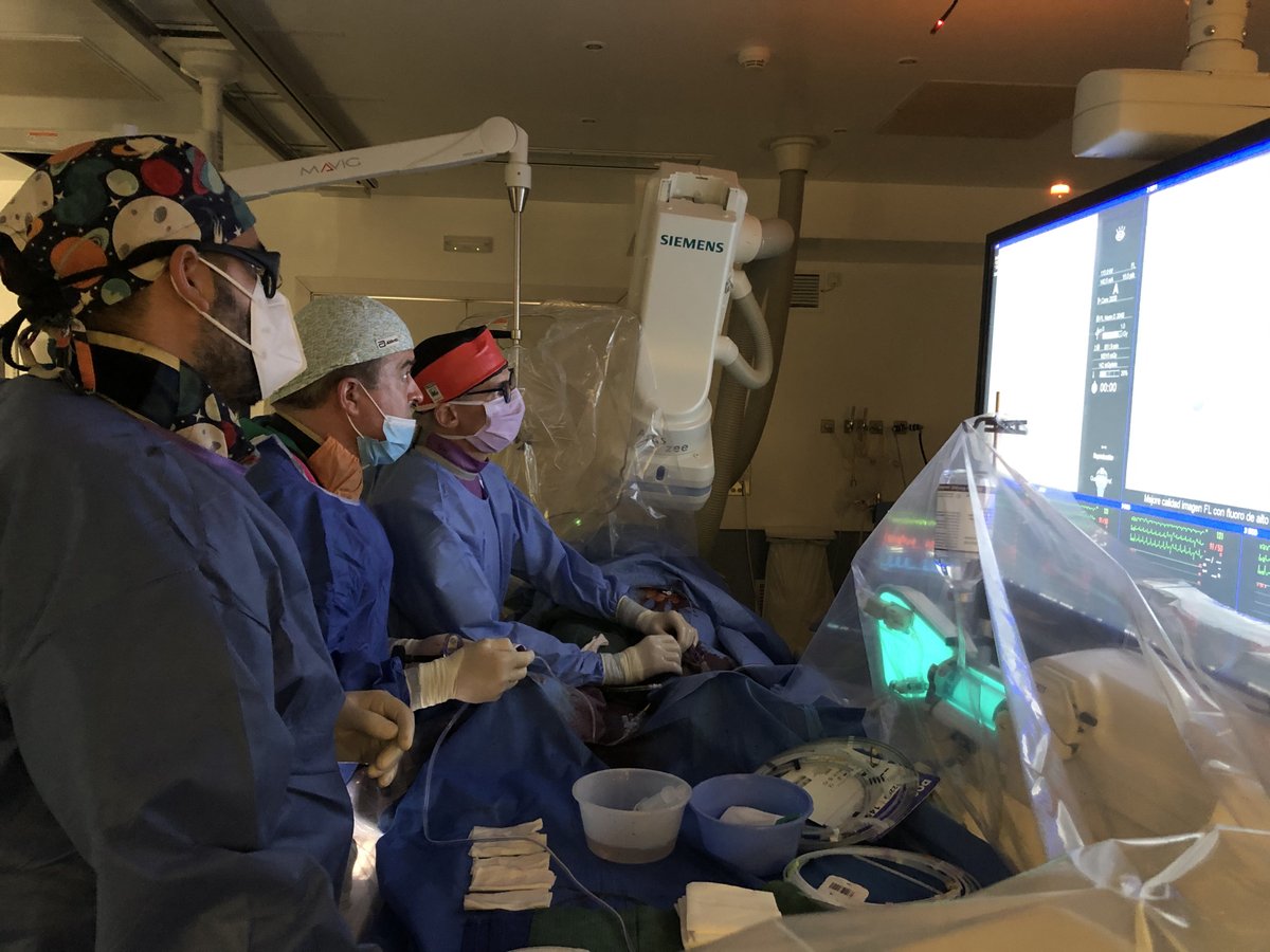 CARDIVAGROUP's tweet photo. El equipo de #cardiólogos intervencionistas del @hbellvitge ha abordado con éxito el primer caso en España con el dispositivo percutáneo de asistencia ventricular pulsátil de #Pulsecath https://t.co/QW9grugt17