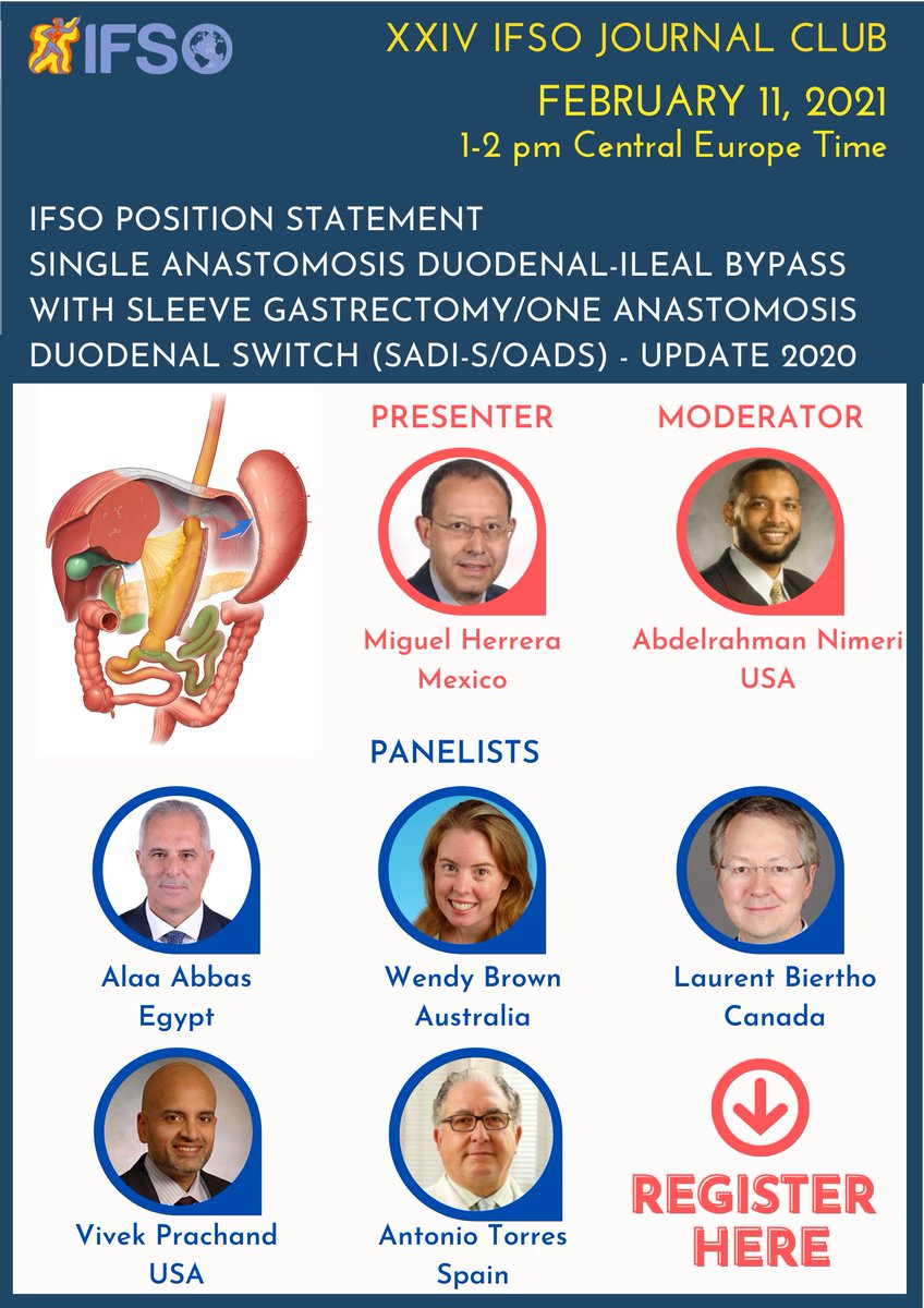 IfsoSecretariat's tweet photo. NEXT WEEK!
XXIV IFSO JOURNAL CLUB
IFSO Position Statement Update 2020: Single Anastomosis Duodenal-Ileal Bypass with Sleeve Gastrectomy/One Anastomosis Duodenal Switch (SADI-S/OADS) 
FEBRUARY 11 at 1-2 pm CET

Register: https://t.co/O1xjd3hmeg
Article: https://t.co/HMEznxcbGi https://t.co/GIOhsypksS