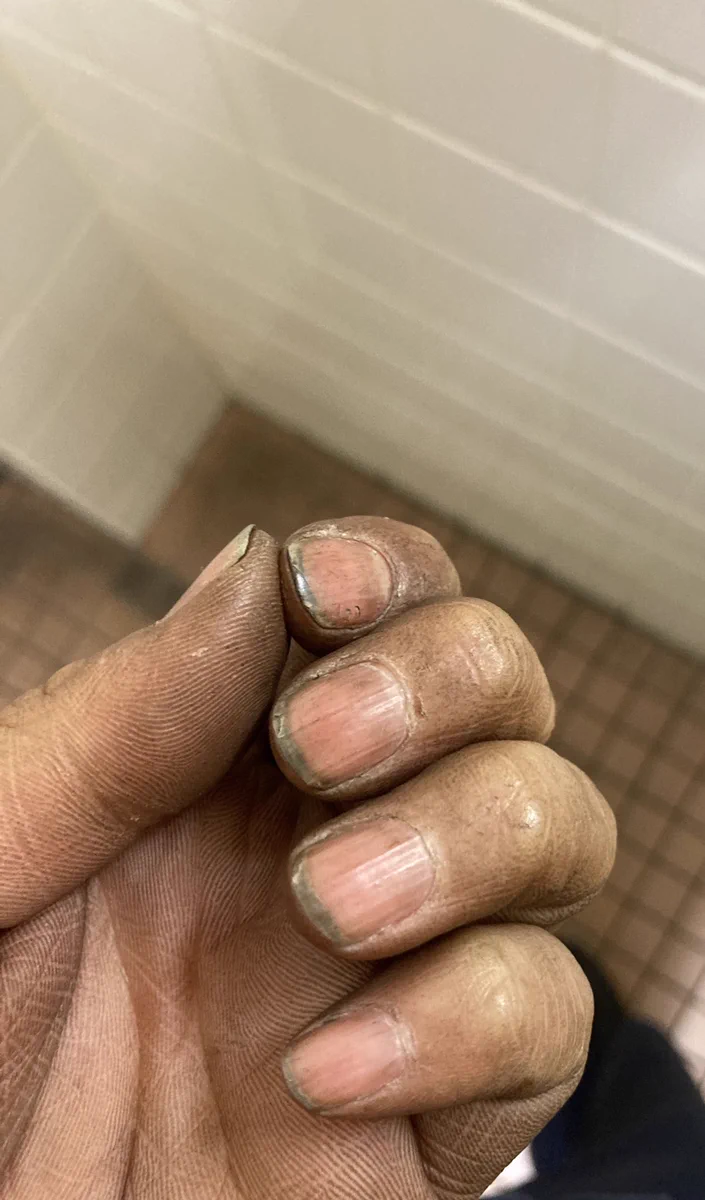 これが25歳女性の手…いっしょうけんめい働いている素晴らしい手！