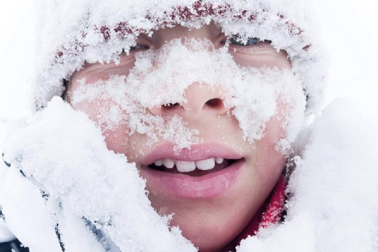 красные щеки от мороза. сильный мороз. иней на лице. сильный мороз. сильный мороз.