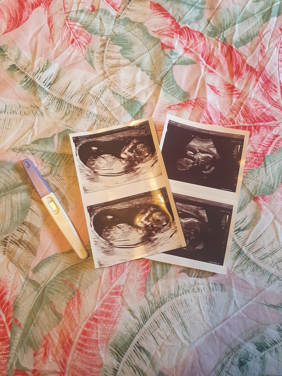 Dulu before datang UK, selalu fikir cemana la Malaysian yg bersalin kat UK. Mesti mahal kan?Sebenarnya free je bersalin kat UK! Alhamdulillah, now im 8 months pregnant,  & this is my UK pregnancy journey 