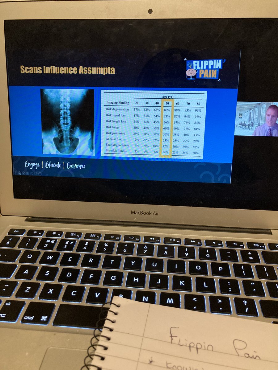 MarkRphysio's tweet photo. Thank you for an enlightening webinar this evening @FlippinPain! It really consolidates how negative and inaccurate information following scans can lead to a poorer outcome for the patients, which has been seen on numerous occasions throughout my MSK outpatient placement. https://t.co/qC8PrjE7cG