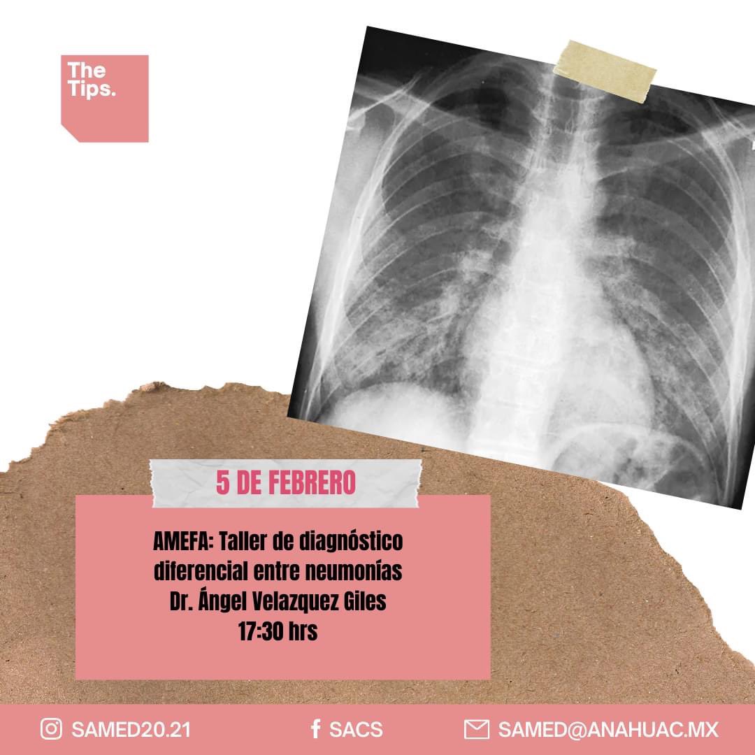 samedAnahuac's tweet photo. Conoce a tus instructores de los talleres clínicos.
¿Todavía no te inscribes?
¡No te preocupes, aún estás a tiempo!
Puedes encontrar el link de registro en nuestra biografía
#TheTips #SAMED #Anáhuac #Medicina https://t.co/IVbdqHvSww