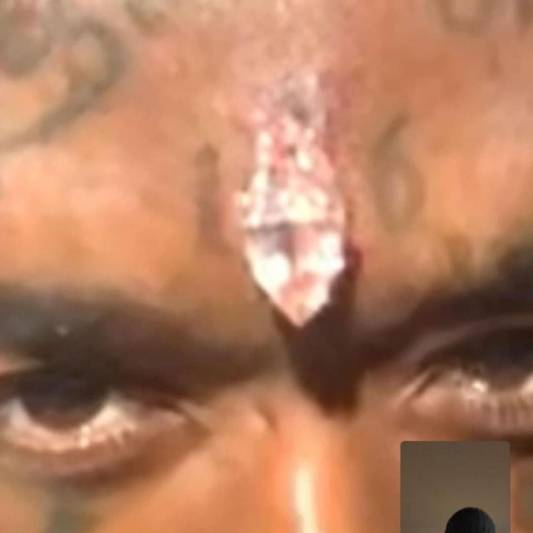 Trapmidias's tweet photo. Lil Uzi Vert implantou um diamante rosa de 24 milhões na testa https://t.co/DKY63wttF1