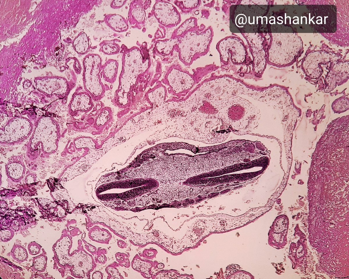tumashankar's tweet photo. Life has just begun, unfortunately at wrong site, to end..
.
.
@archibhat3 @VijayPatho @lovelygeorge10 @Swathiprabhu5 @Vasudevprabhu3 #PathTwitter #Tweacher #PathTweacher https://t.co/WeUwizrjqf