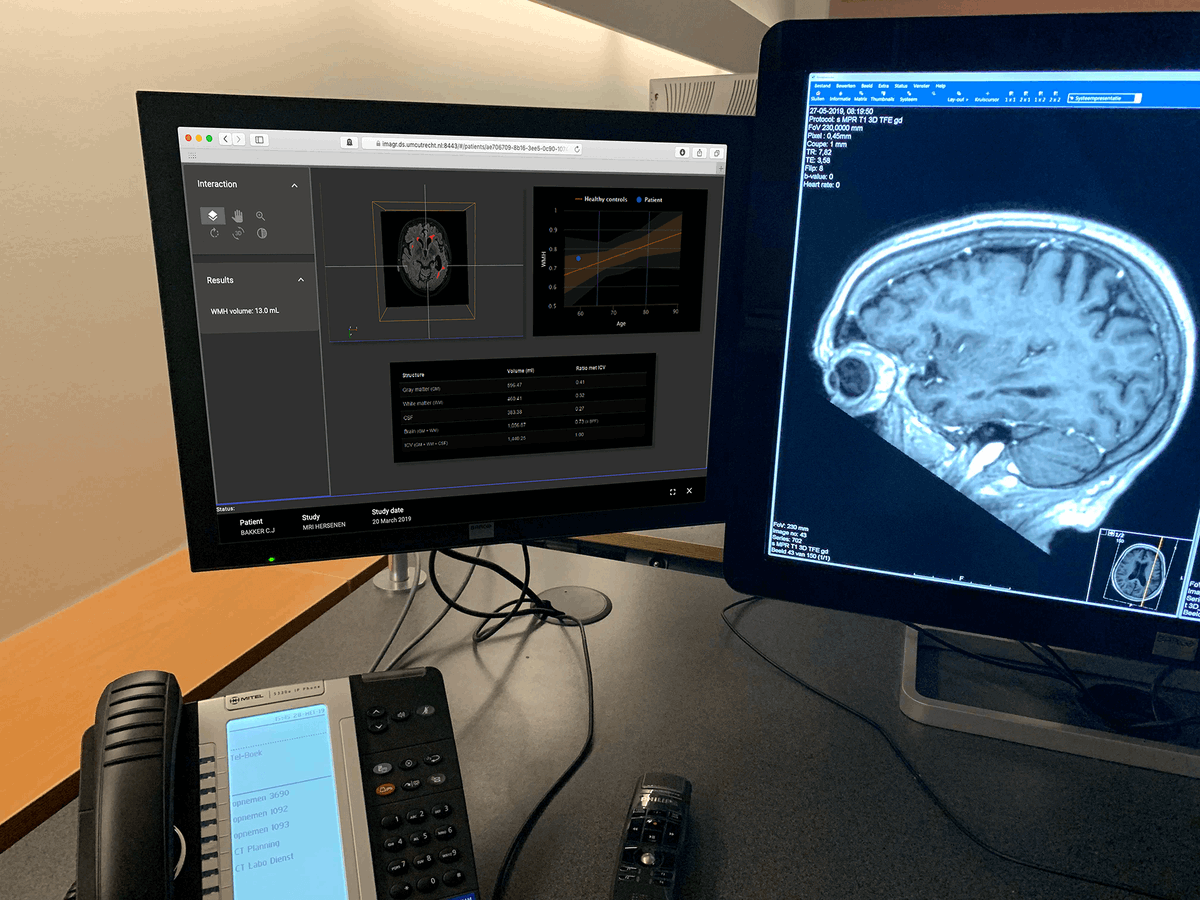 doRadiology's tweet photo. 🎉  Insights into Imaging @ESR_Journals just published our review describing what we have learned from building and running a VNAI #AI infrastructure at the @UMCUtrecht @ISI_UMC

👉🏼https://t.co/oDhchLzy7n (open access) 

w/ ChristianMol EdwinBennink @hjkuijf @Koen_Vincken @MRAguy https://t.co/nVTLdI7tU2