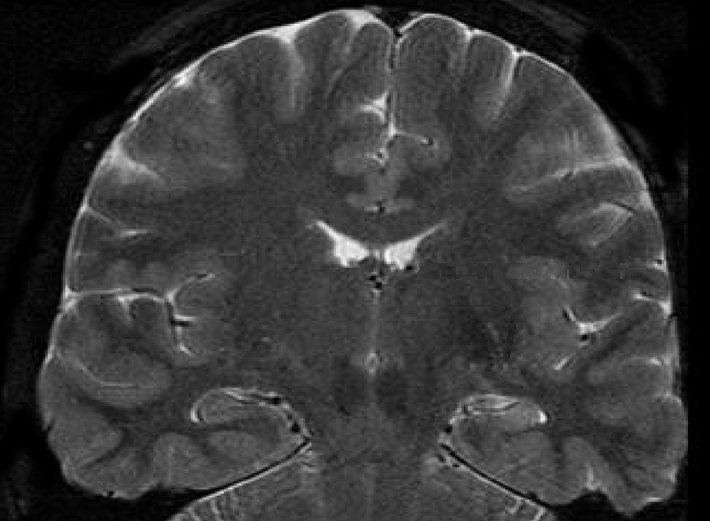 Lets limit ourselves to the visual system: With practice, we can get better at performing fine visual tasks, even in adulthood. Consider the challenge of finding a tumor in a brain scan. Or a stress fracture in an X-ray. Can you?