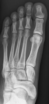 Lets limit ourselves to the visual system: With practice, we can get better at performing fine visual tasks, even in adulthood. Consider the challenge of finding a tumor in a brain scan. Or a stress fracture in an X-ray. Can you?