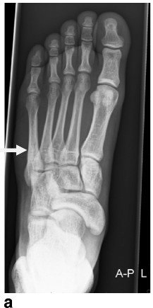 With training, experts can do these tasks very accurately. Here is the tumor and fracture indicated, not easy! Luckily the visual system is plastic enough to LEARN these discriminations.